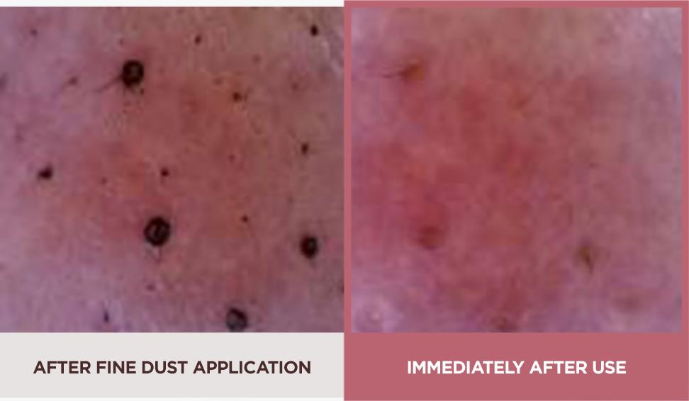 Su:m37° - Micro-Active Pink Vitamin Bubbletox Mask Pack