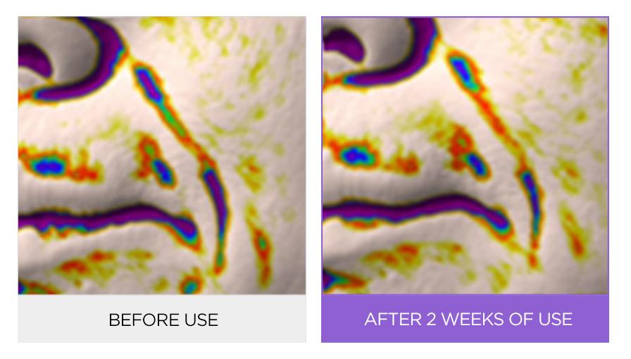 O Hui - Age Recovery Collagen Ampoule Expert