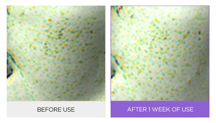 O Hui - Age Recovery Essence