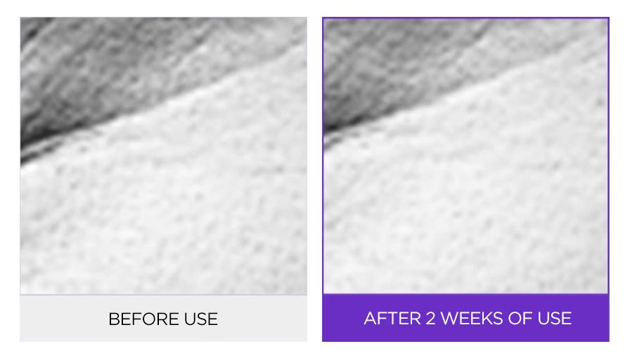 O Hui - Age Recovery Essence