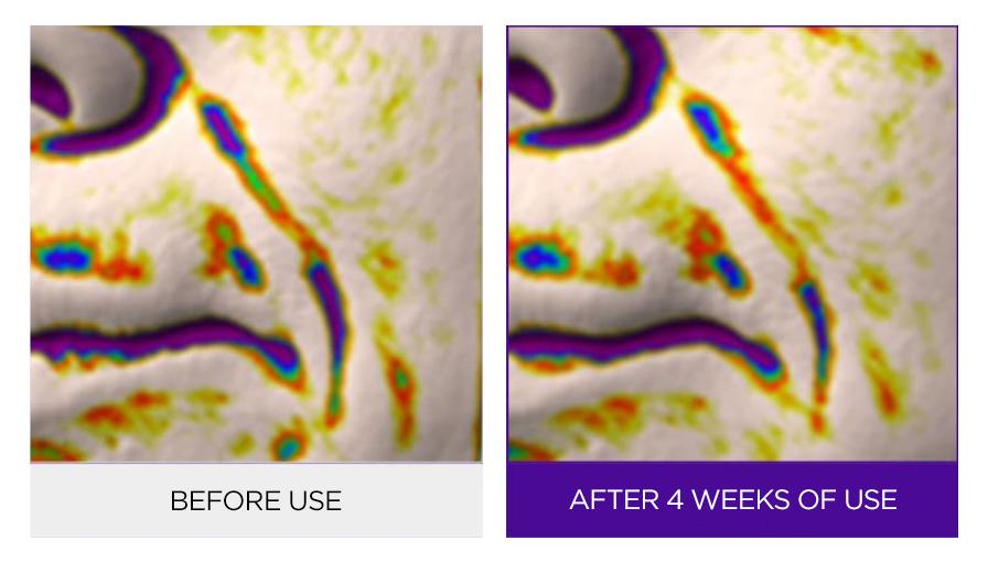 O Hui - Age Recovery Essence