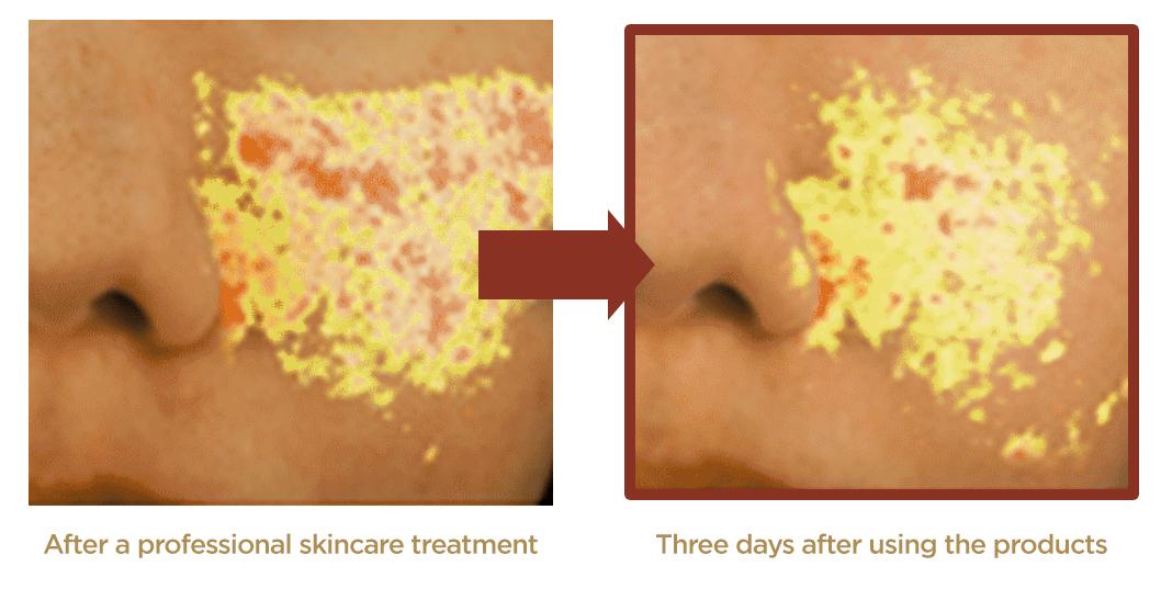 O Hui - The First Geniture Skin Softener