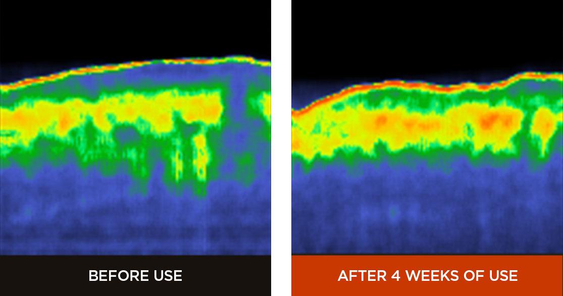 Hera - Signia Core Lifting Serum
